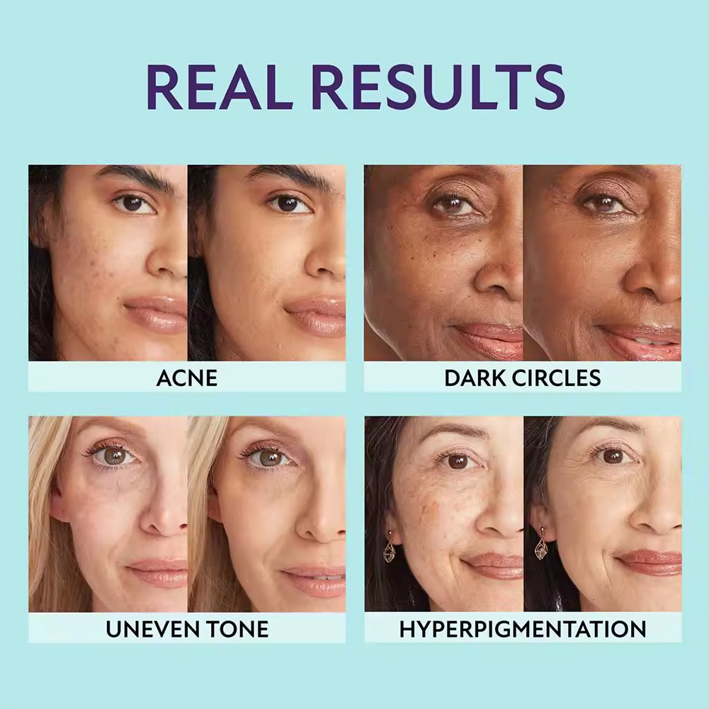 Supreme Cream – All-in-one moisturizer, concealer and coverage – Lightweight and waterproof