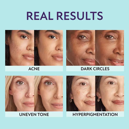 Supreme Cream – All-in-one moisturizer, concealer and coverage – Lightweight and waterproof