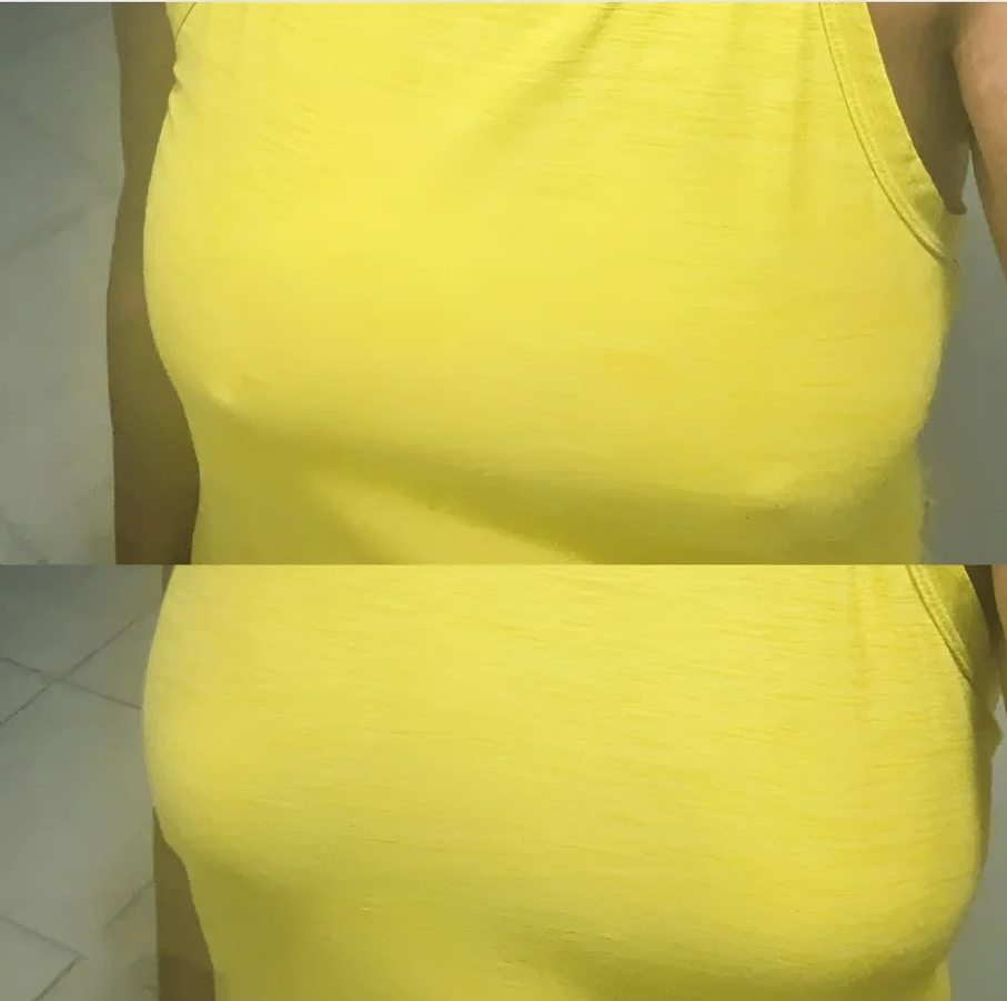 NipGrip™-Nipple Covers